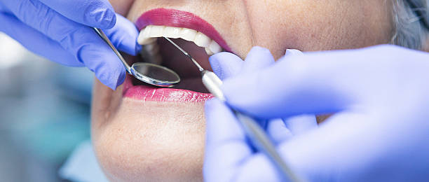Best Urgent Care for Lost Fillings or Crowns in Sunnyside, WA