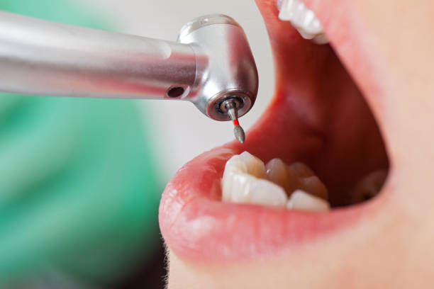 Best After-Hours Dental Trauma Care in Sunnyside, WA
